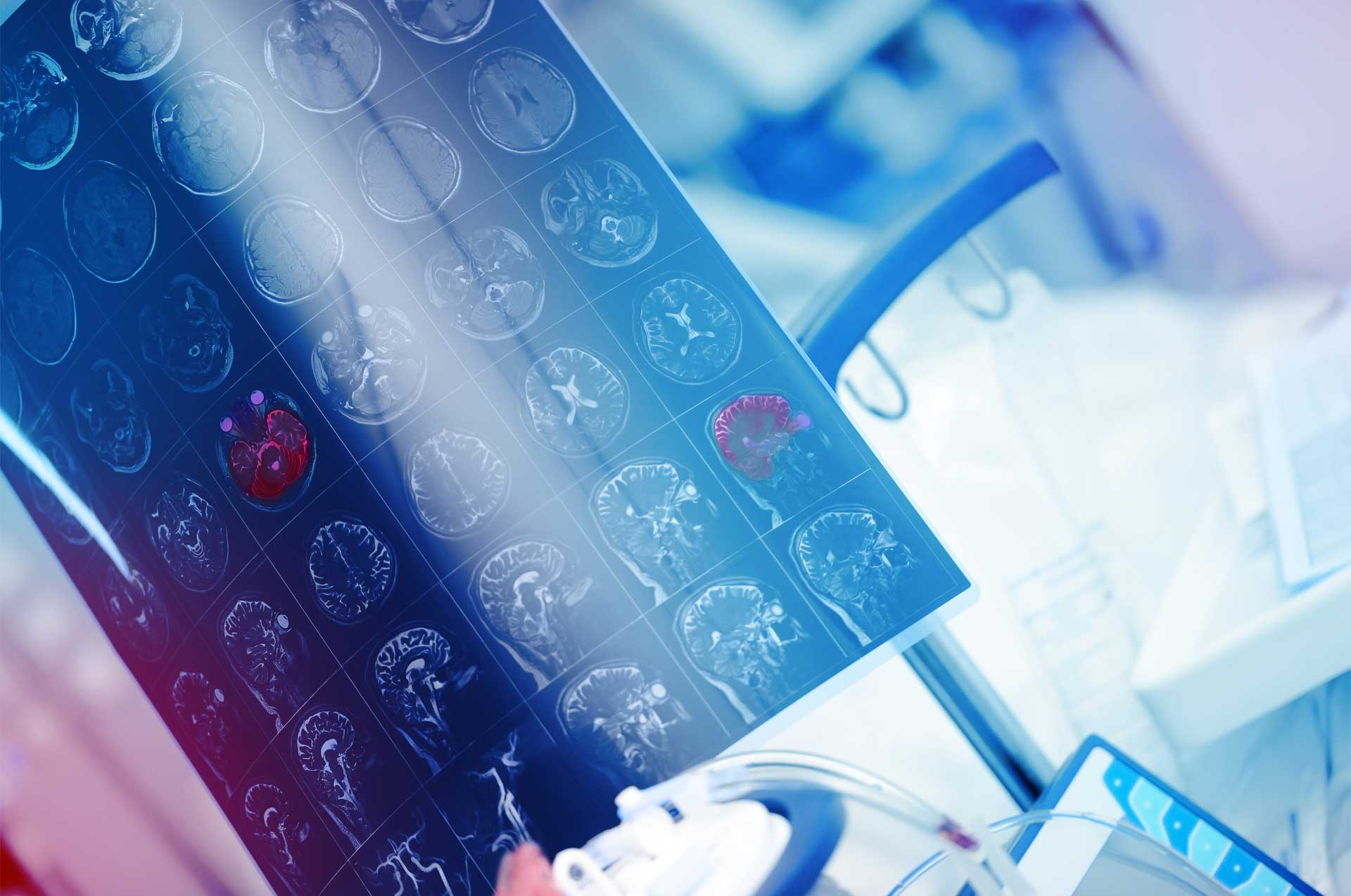 Avances en epilepsia en 2026: congresos, publicaciones y formación